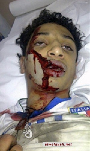استشهاد الشاب البحريني علي جواد الشيخ برصاص قوات الأمن