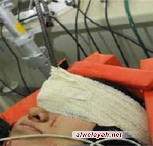 استشهاد فتاة بحرينية إثر إصابتها بيد قوات الأمن الخليفية